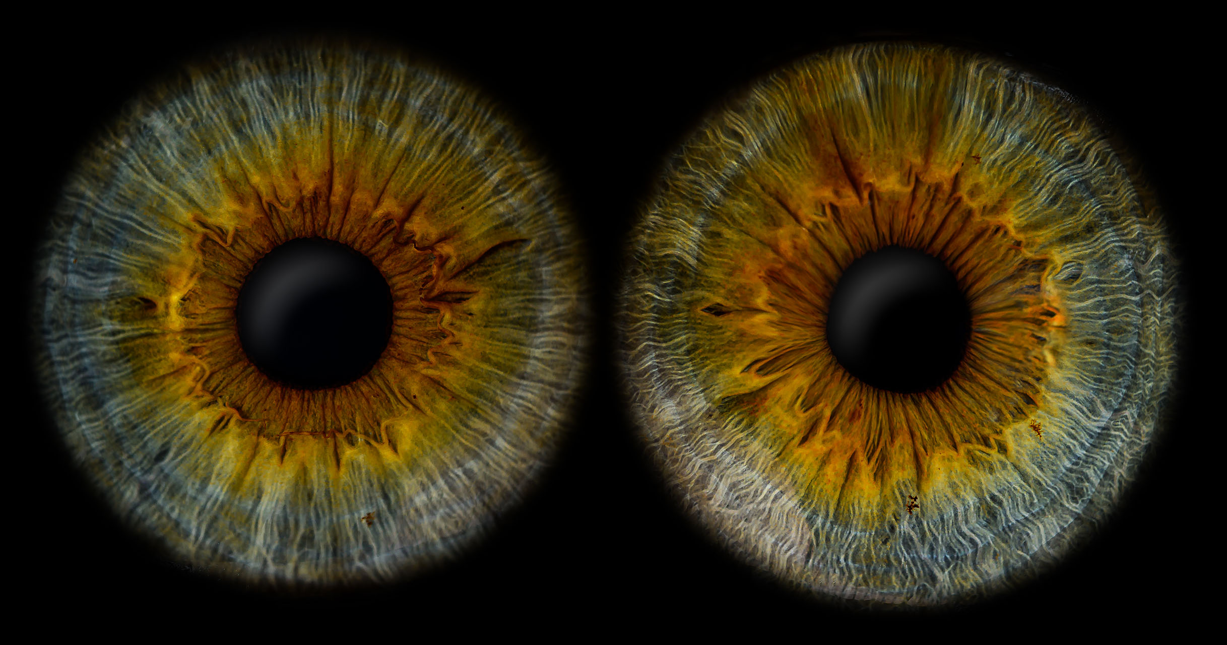 Irisfotografie by Rüdiger Kottmann - Rabea beide Augen