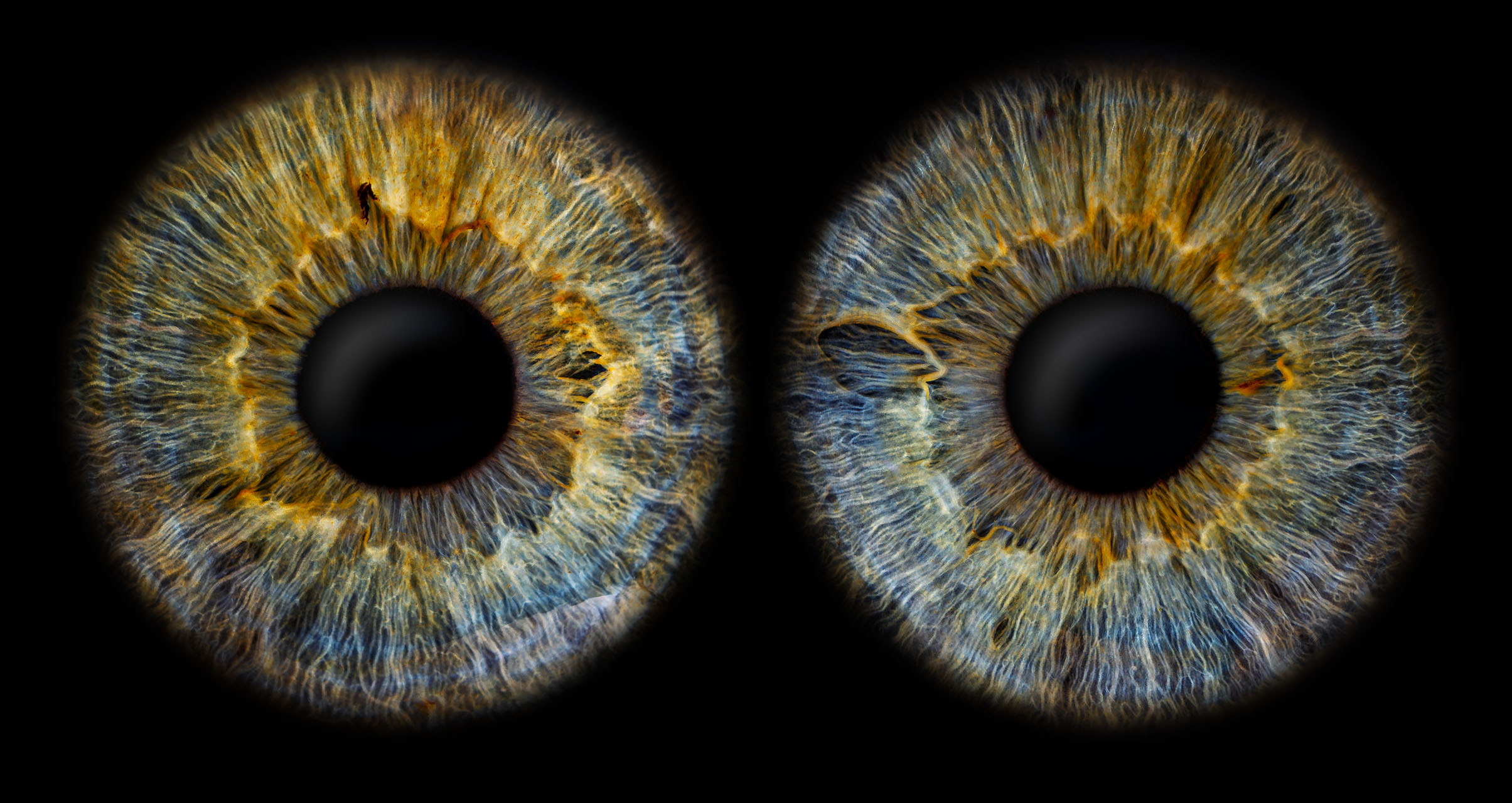Irisfotografie - Saskia beide Augen
